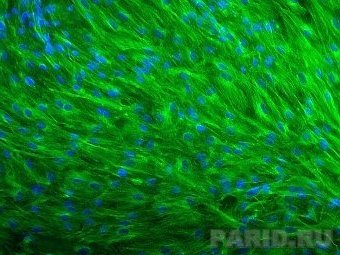 Тубулин (зеленый) в фибробластах человека. Фото SFG/Flickr